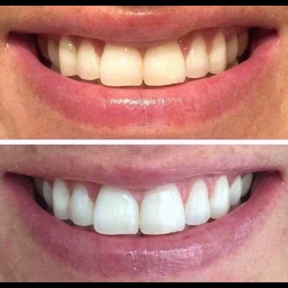 THE BEST Whitening Toothpaste!  NO HARSH CHEMICALS - Picture 2 of 12